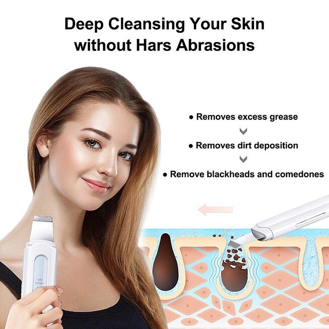 Winjoy Ultrasonic Skin Scrubber Blackhead Remover 4-Mode Beauty Tools, , alternate image number null