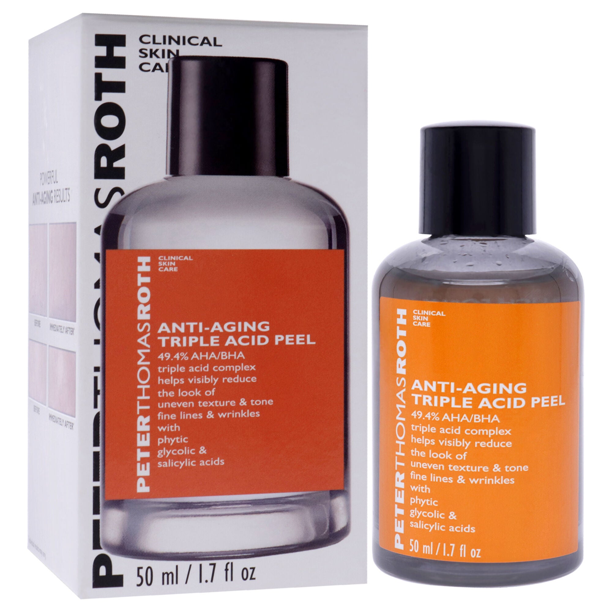 Anti Aging Triple Acid Peel by Peter Thomas Roth for Women - 1.7 oz Treatment, , alternate image number 7