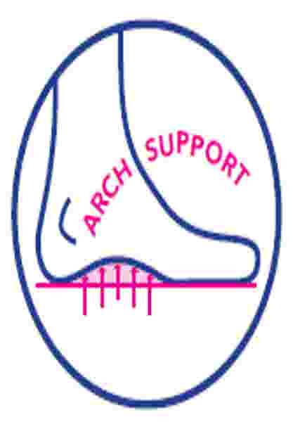 The Niccola Arch Support Mule image number 5